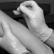 VACCINO ANTIVAIOLO ... il "tatuaggio" dei giovani degli anni 50 e '60